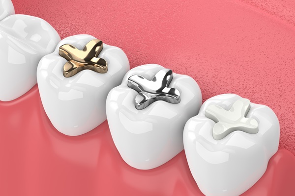 What To Know About Dental Filling Material Options